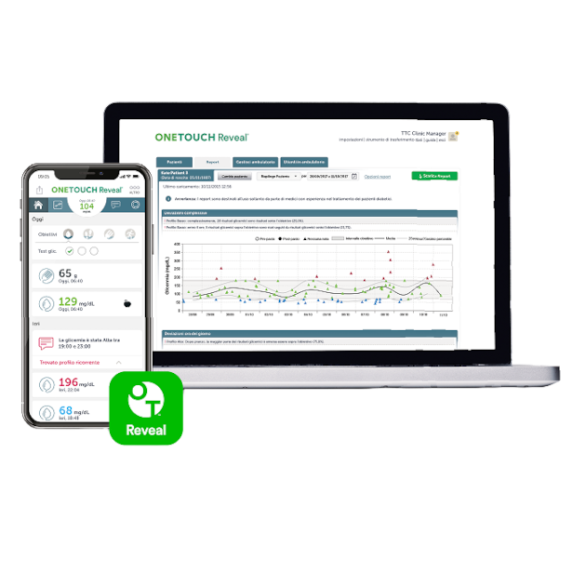A laptop and a smartphone showing the ONETOUCH Reveal software, presenting glucose monitoring data and analysis.